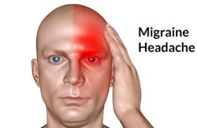 27 Migraine ไมเกรน2