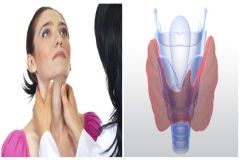Thyroid01