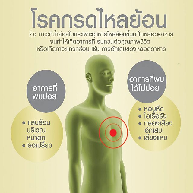 Acid reflux กรดไหลย้อน 1