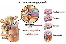 Coluna vertebral cervical ou pescoço 3