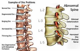 Coluna vertebral cervical ou pescoço 6